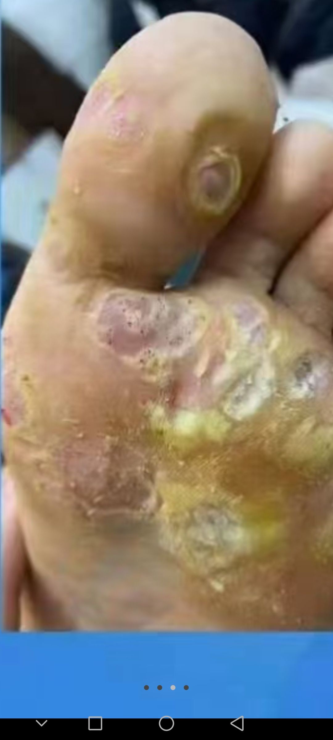 陕西专业修脚房(金龙路店)