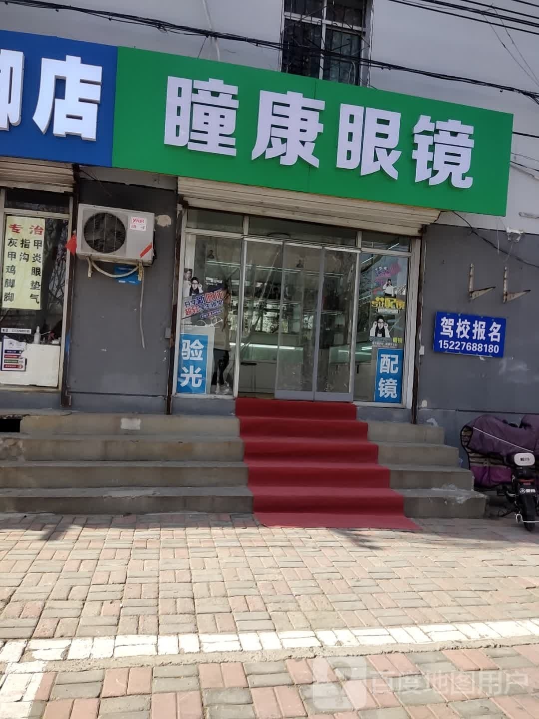瞳康眼睛