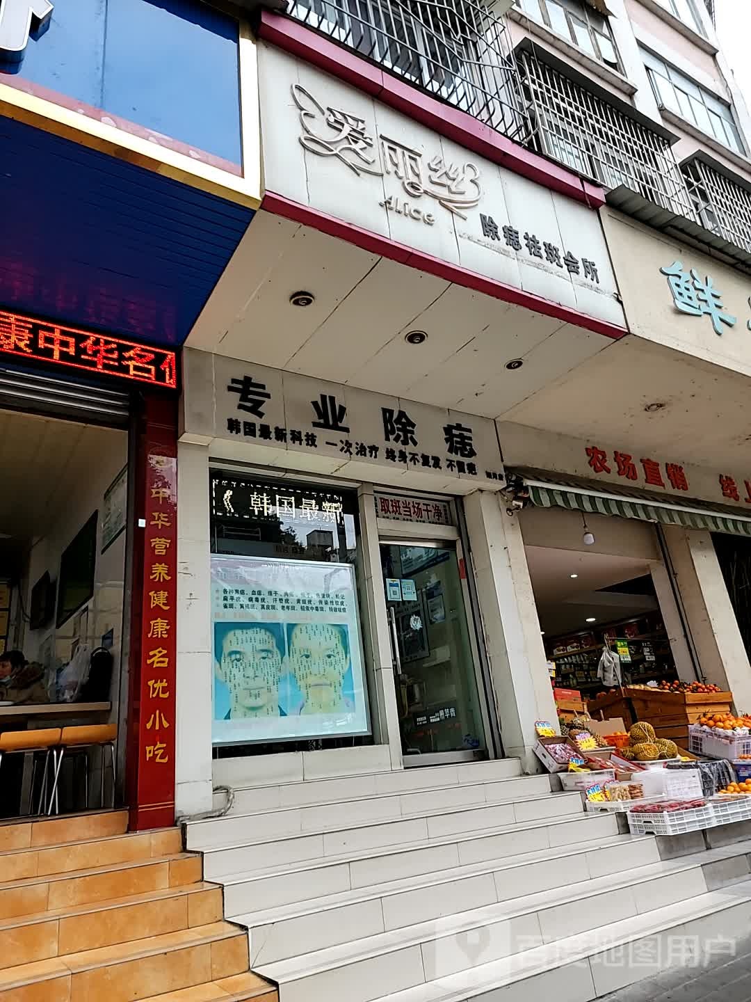 艾丽丝除痣祛斑会所