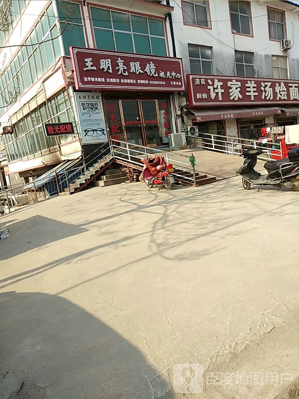 王明亮眼睛