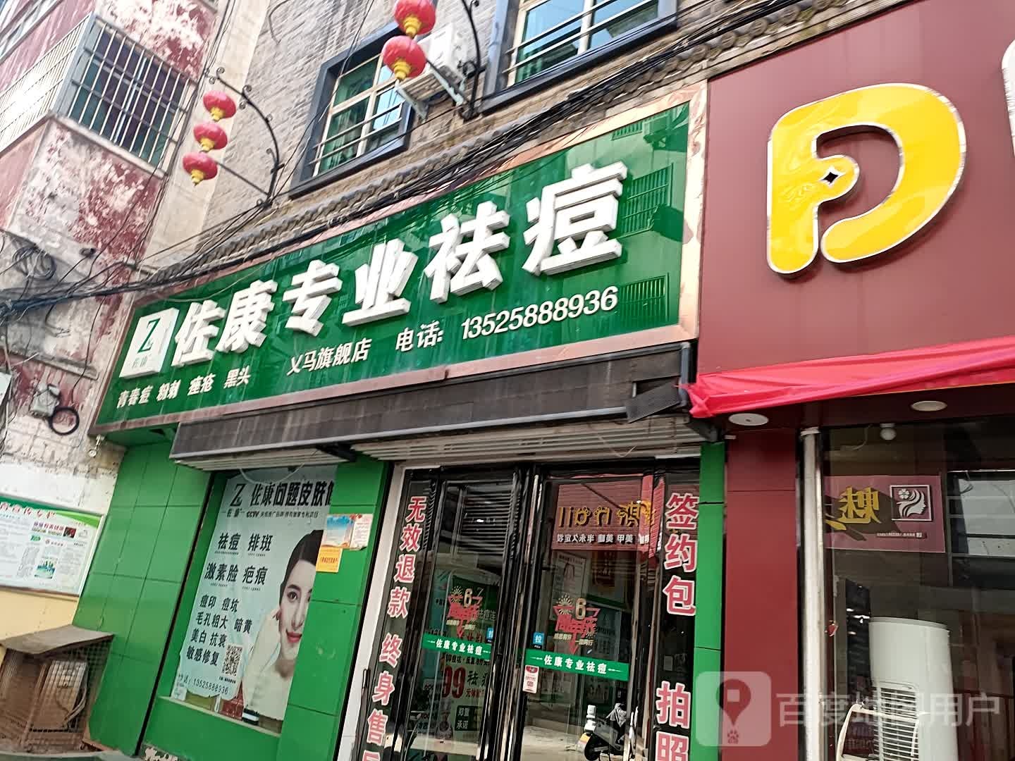 佐康专家祛痘(三门峡义马店)