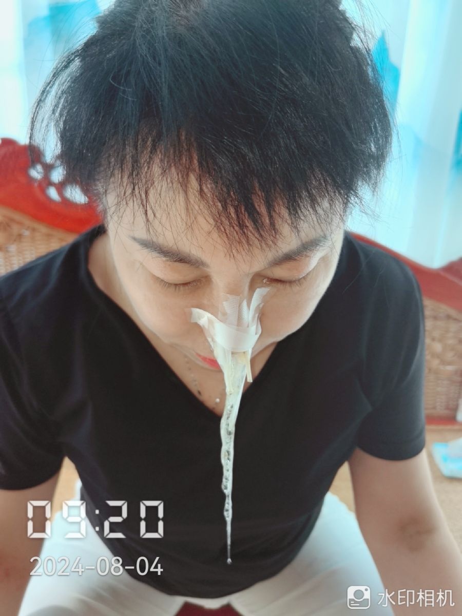 钟氏九代锤蒸正骨