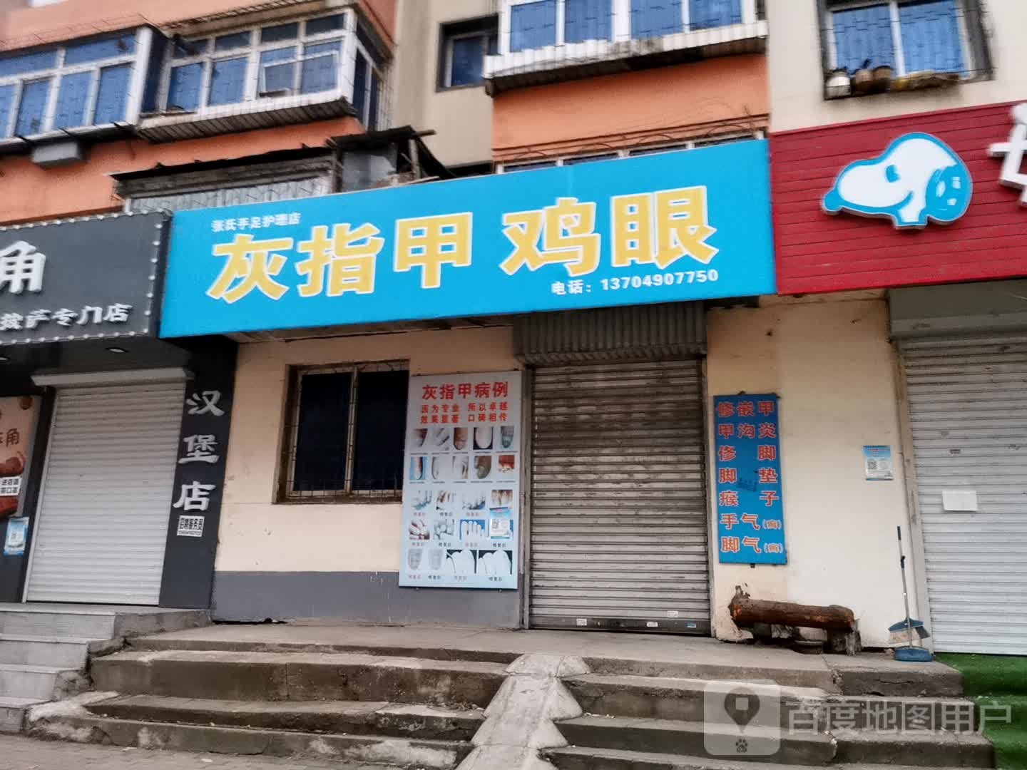 张氏手足护理店