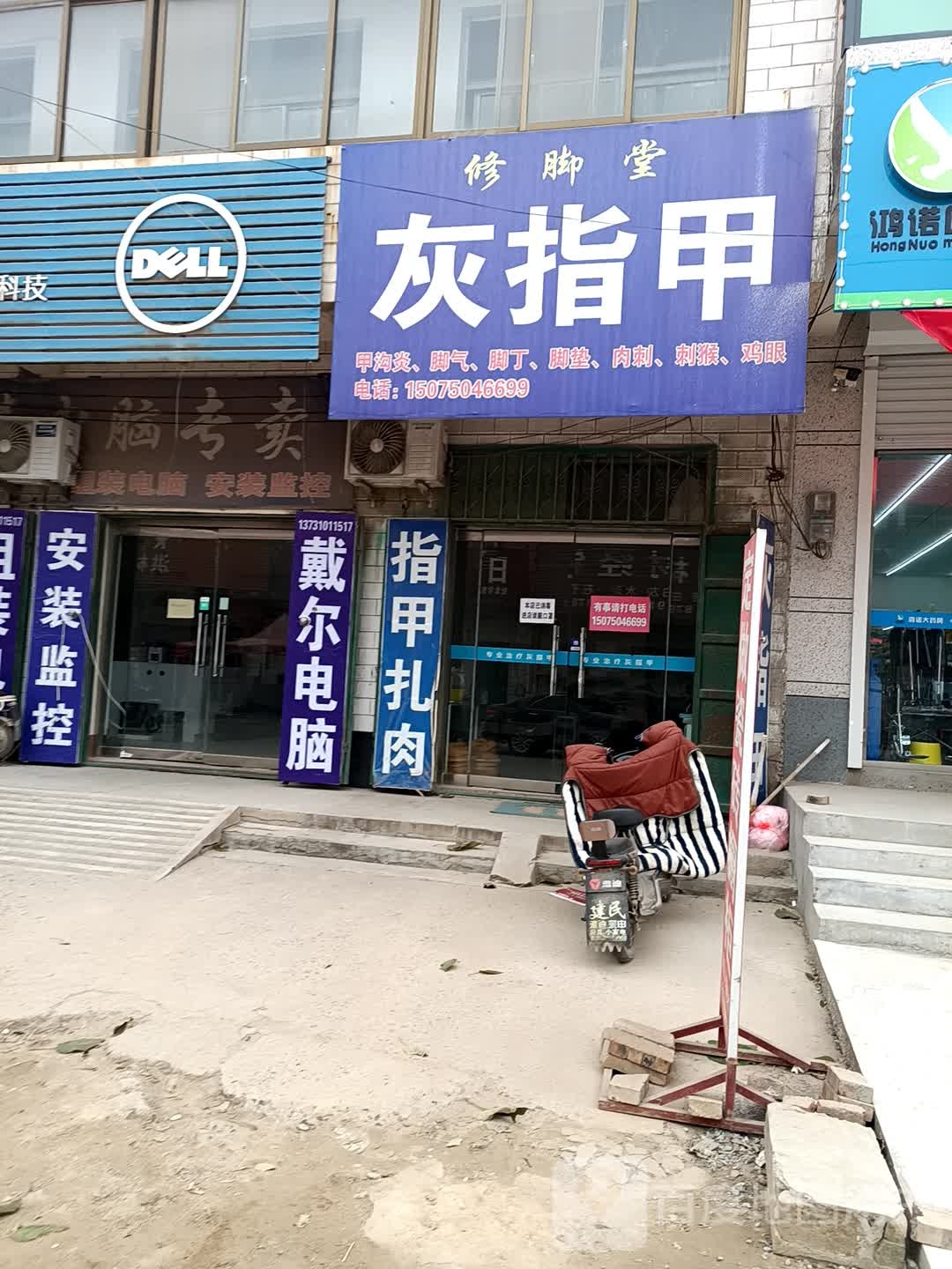 修脚堂灰指甲