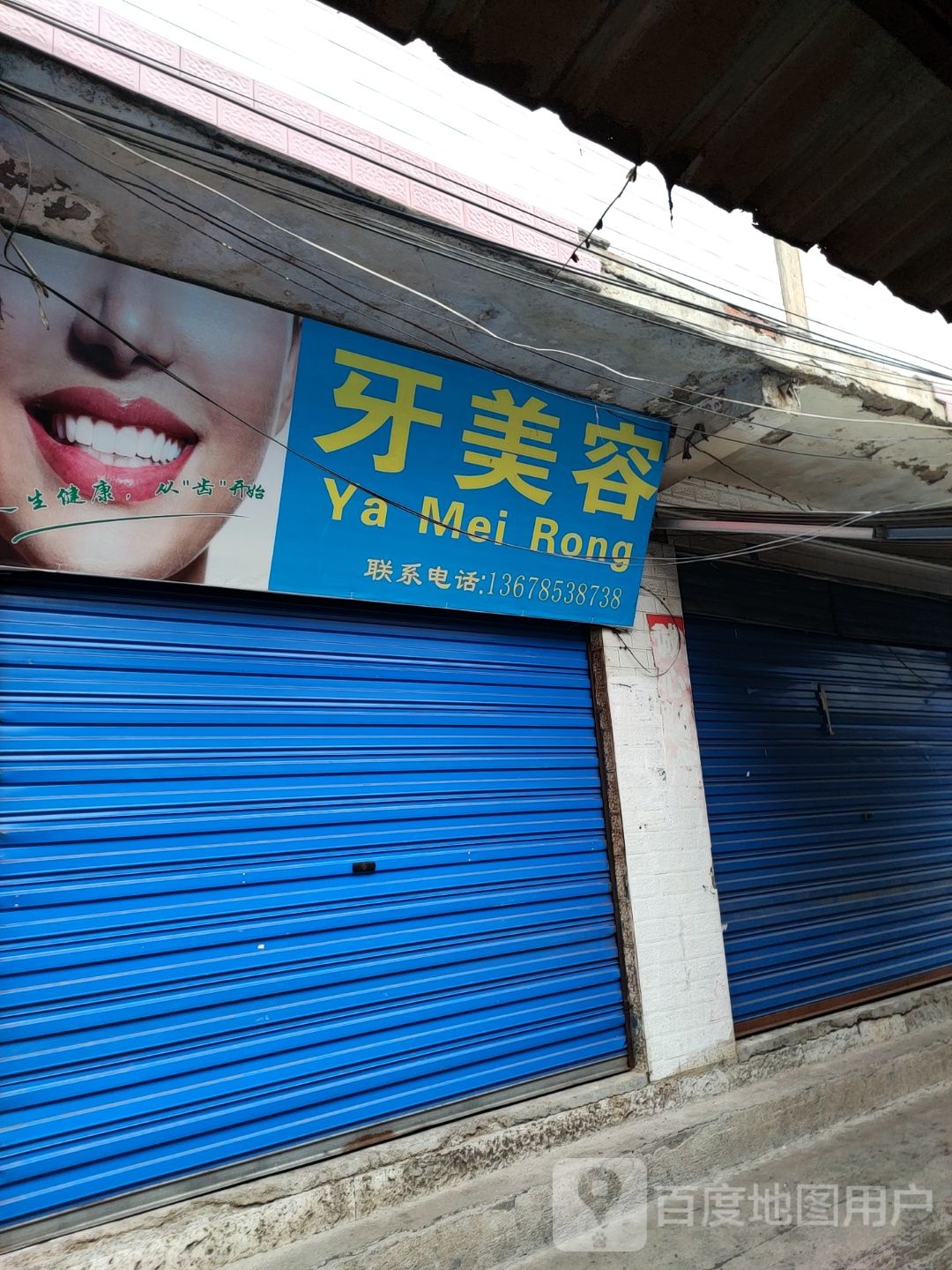 牙美容