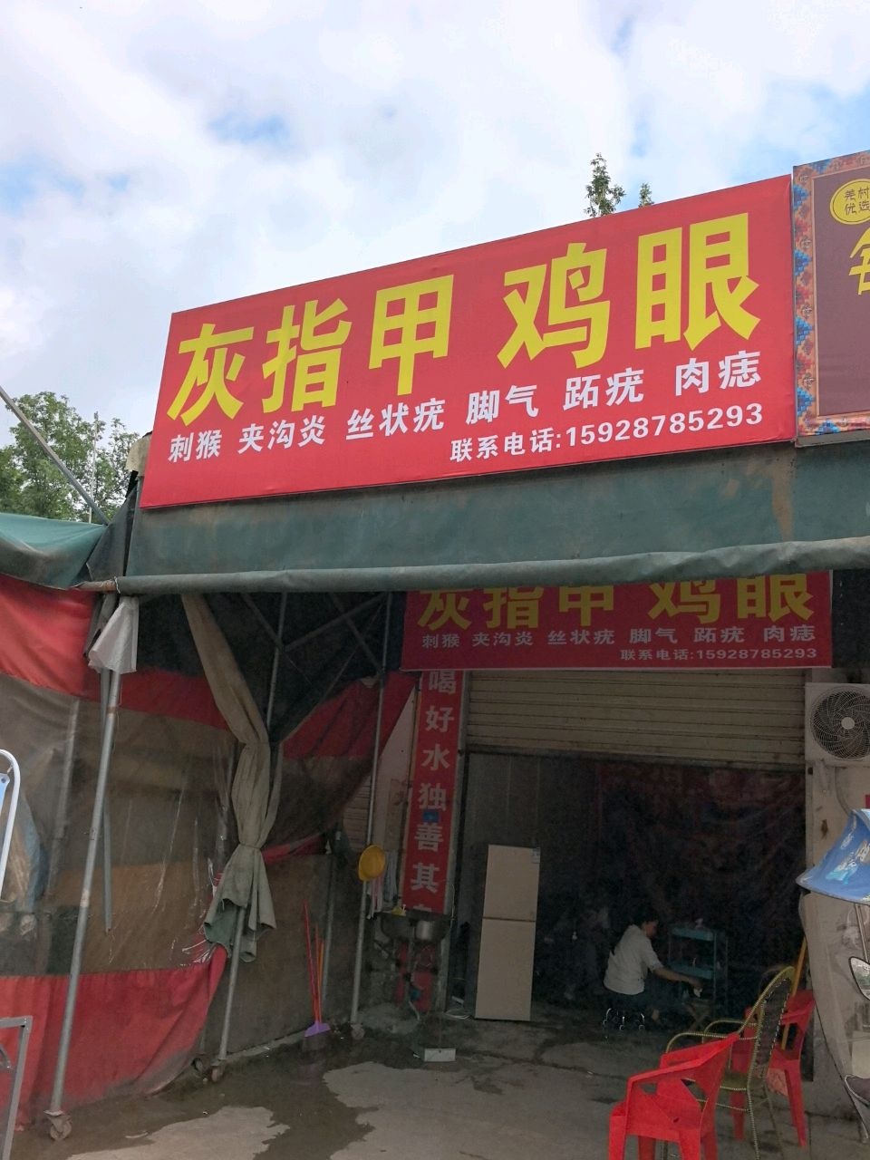 灰指甲鸡眼