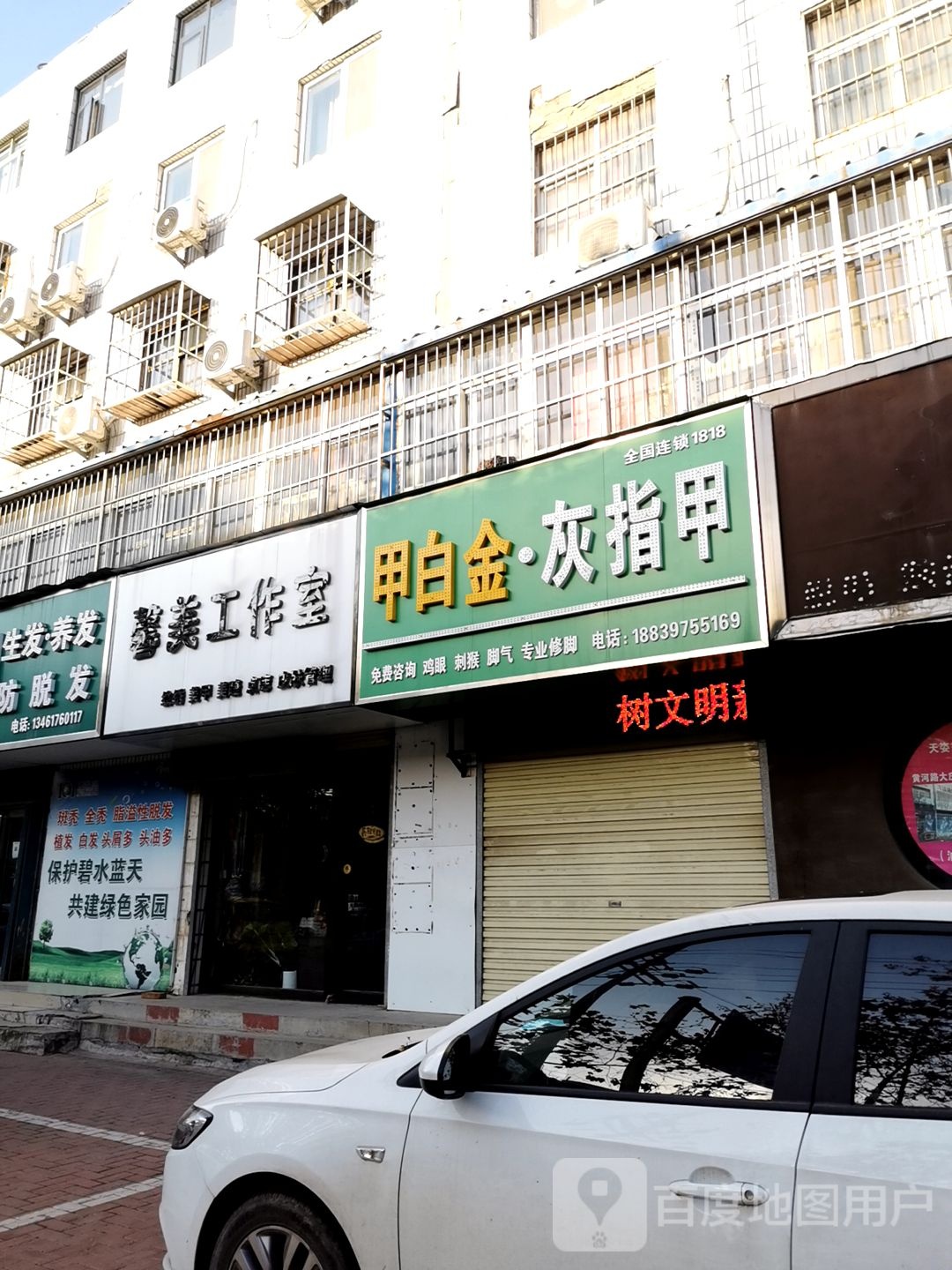 甲白金灰指甲