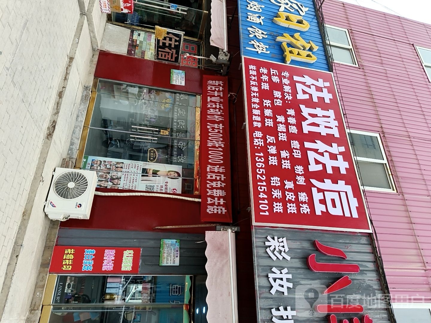 祛斑去痣