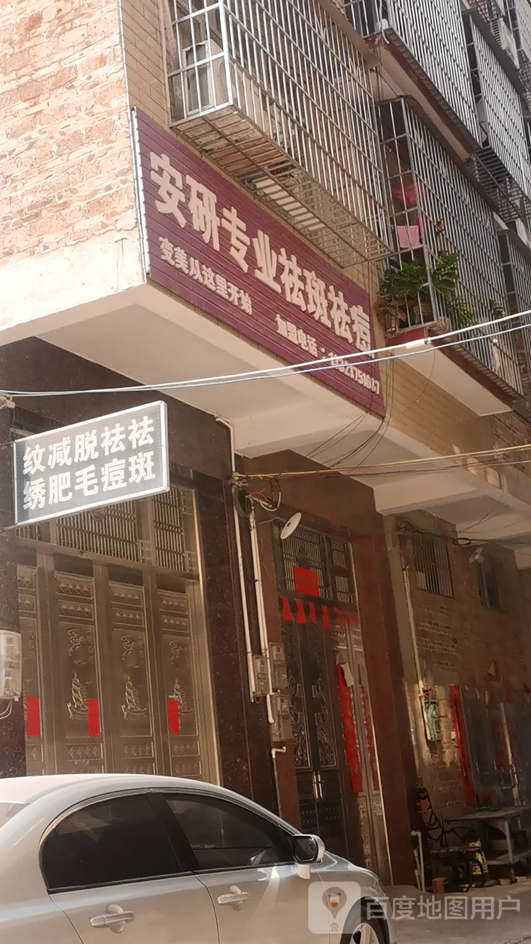 安研专业祛斑祛痘