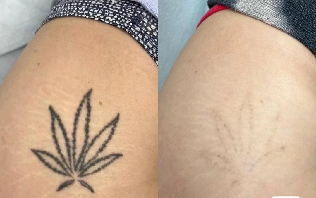 刺客纹身馆洗纹身包干净