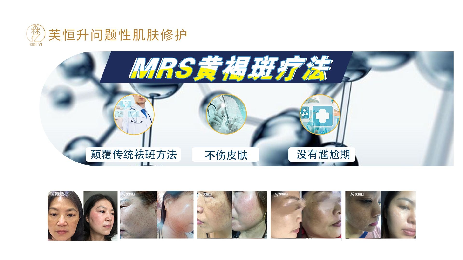 夏沫美肤中新