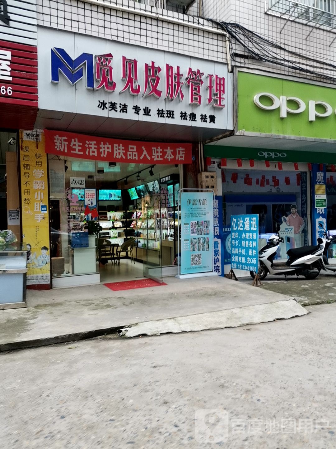 觅见?皮管理