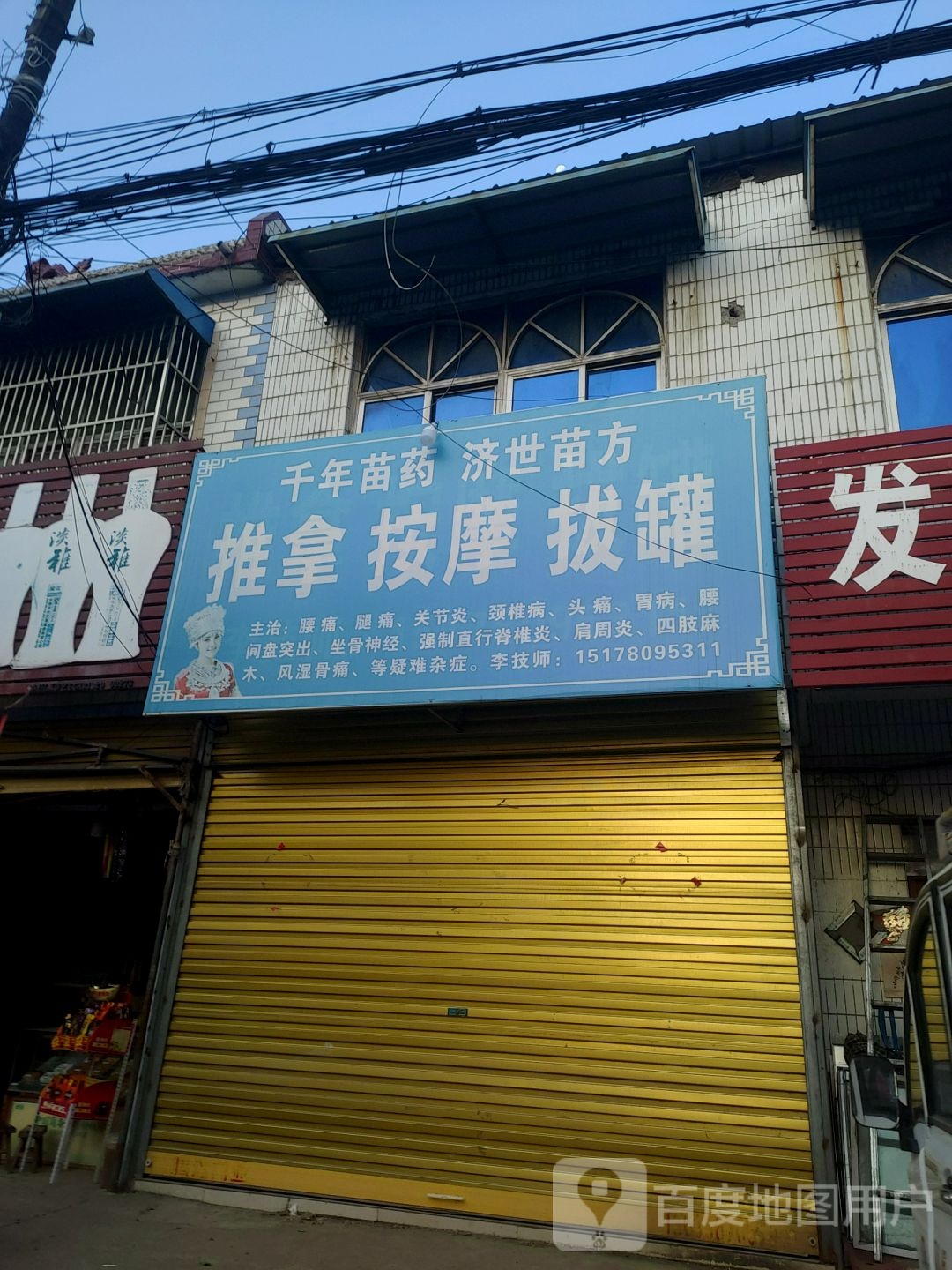 推拿按摩拔罐