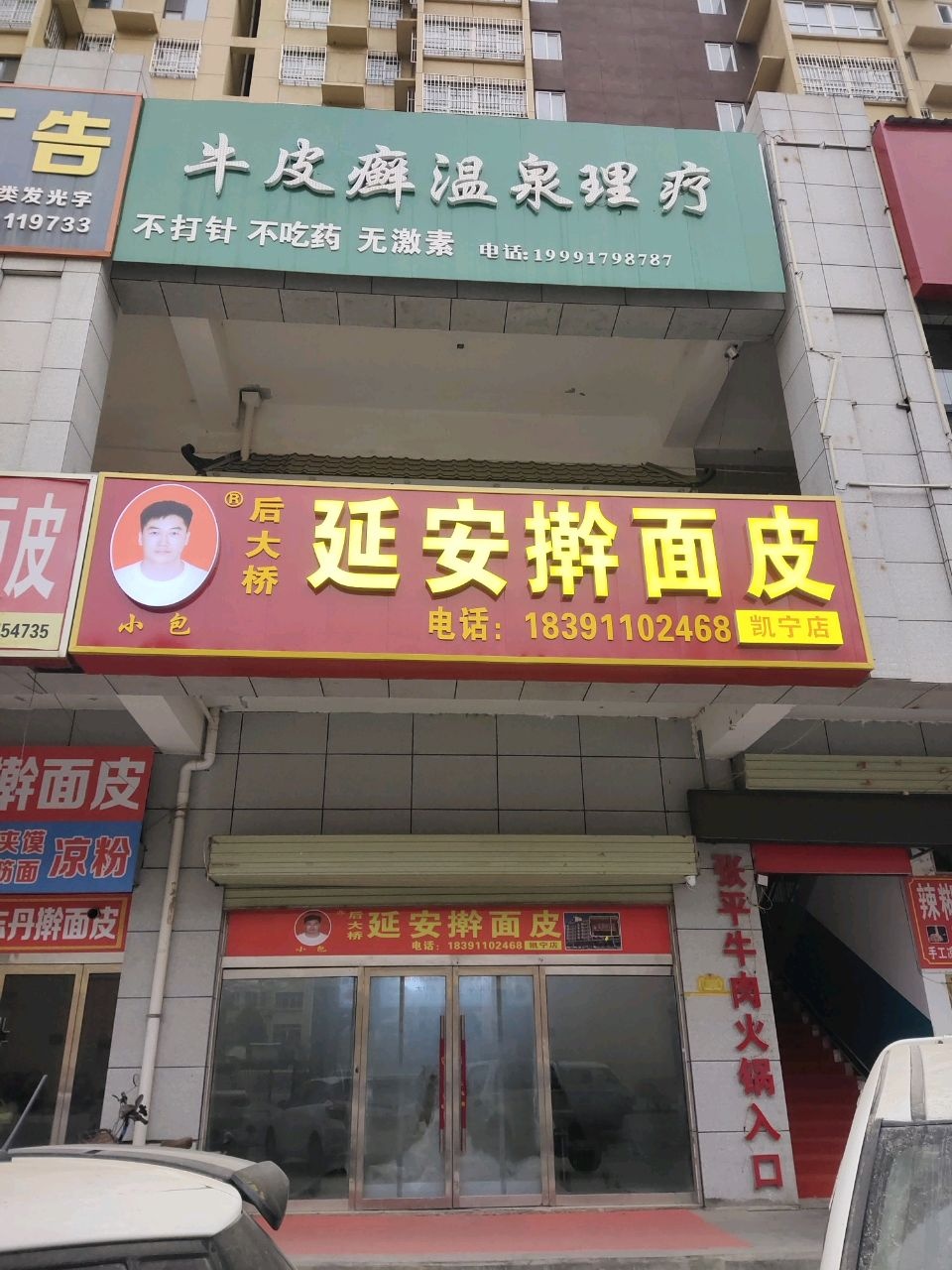 牛皮癣温泉理疗
