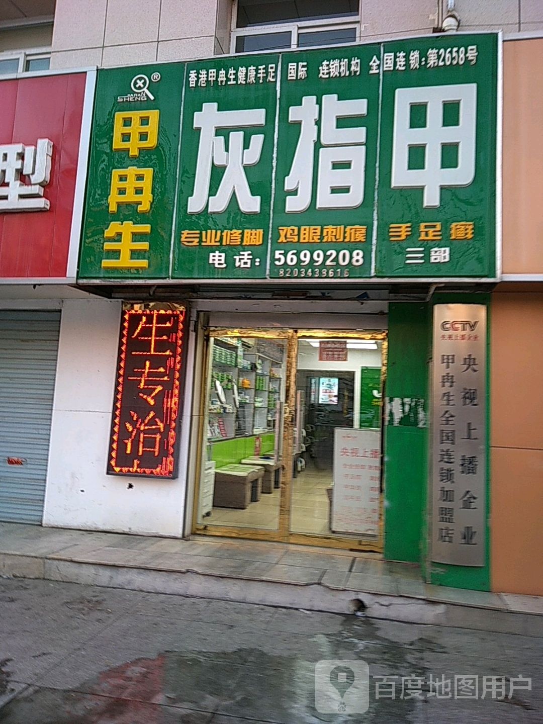 甲冉生灰指甲(北大街)