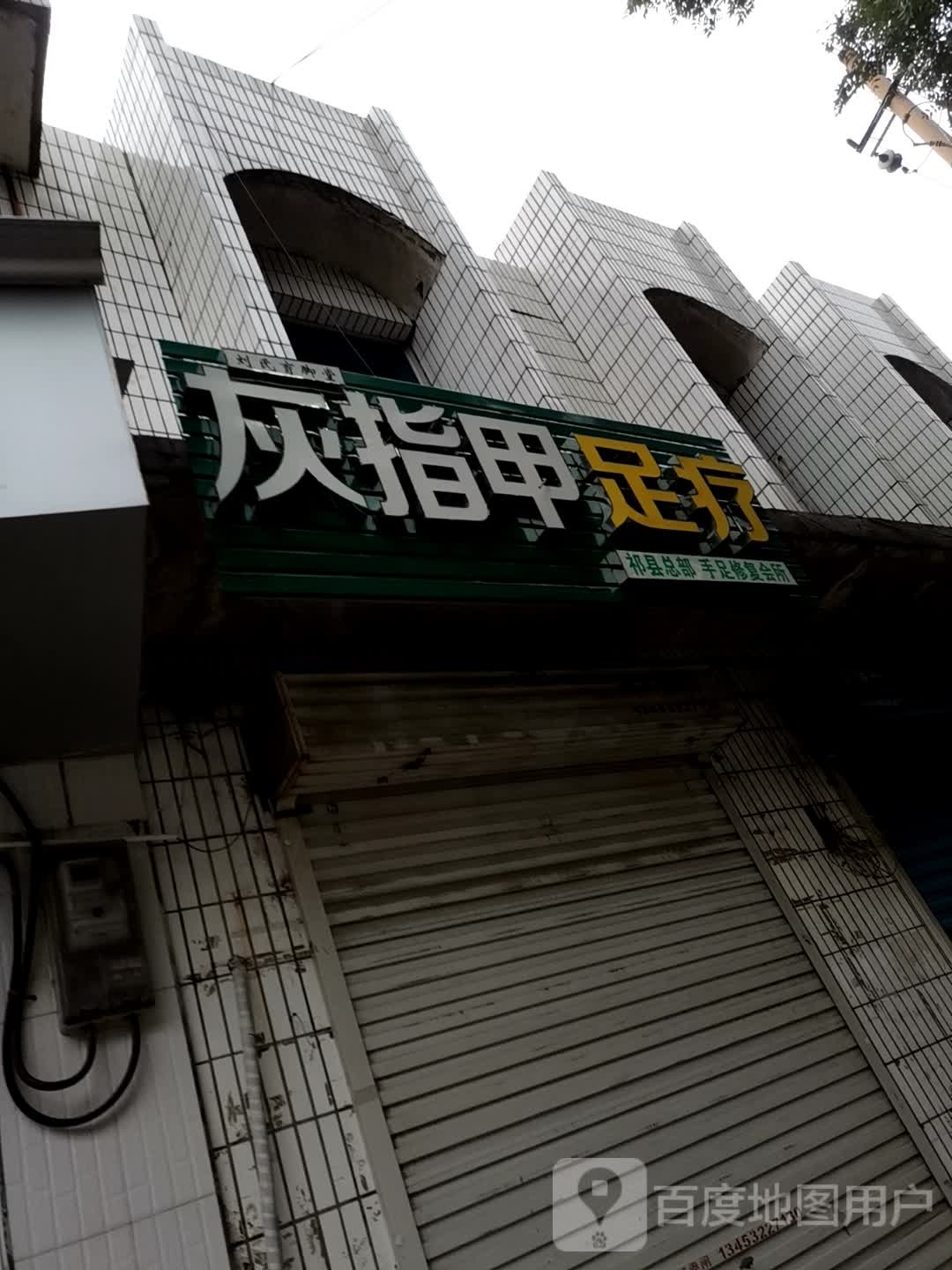 灰指甲足疗