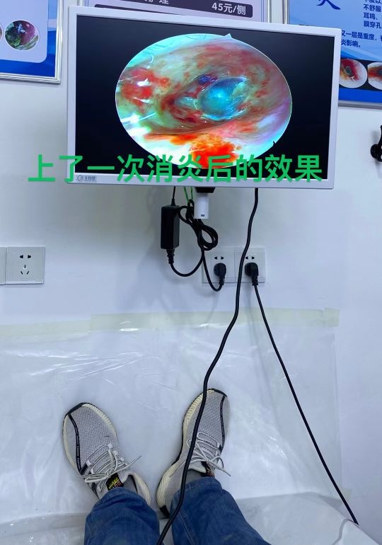丰耳堂可视采耳