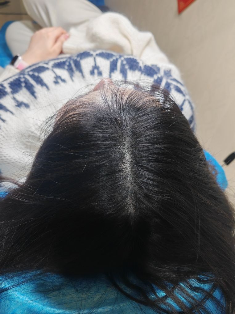 长春顶点3D纹发