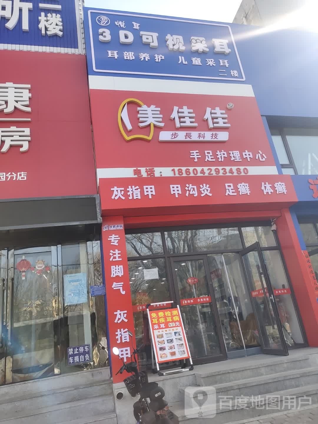 悦耳3D可视采耳(三角公园店)