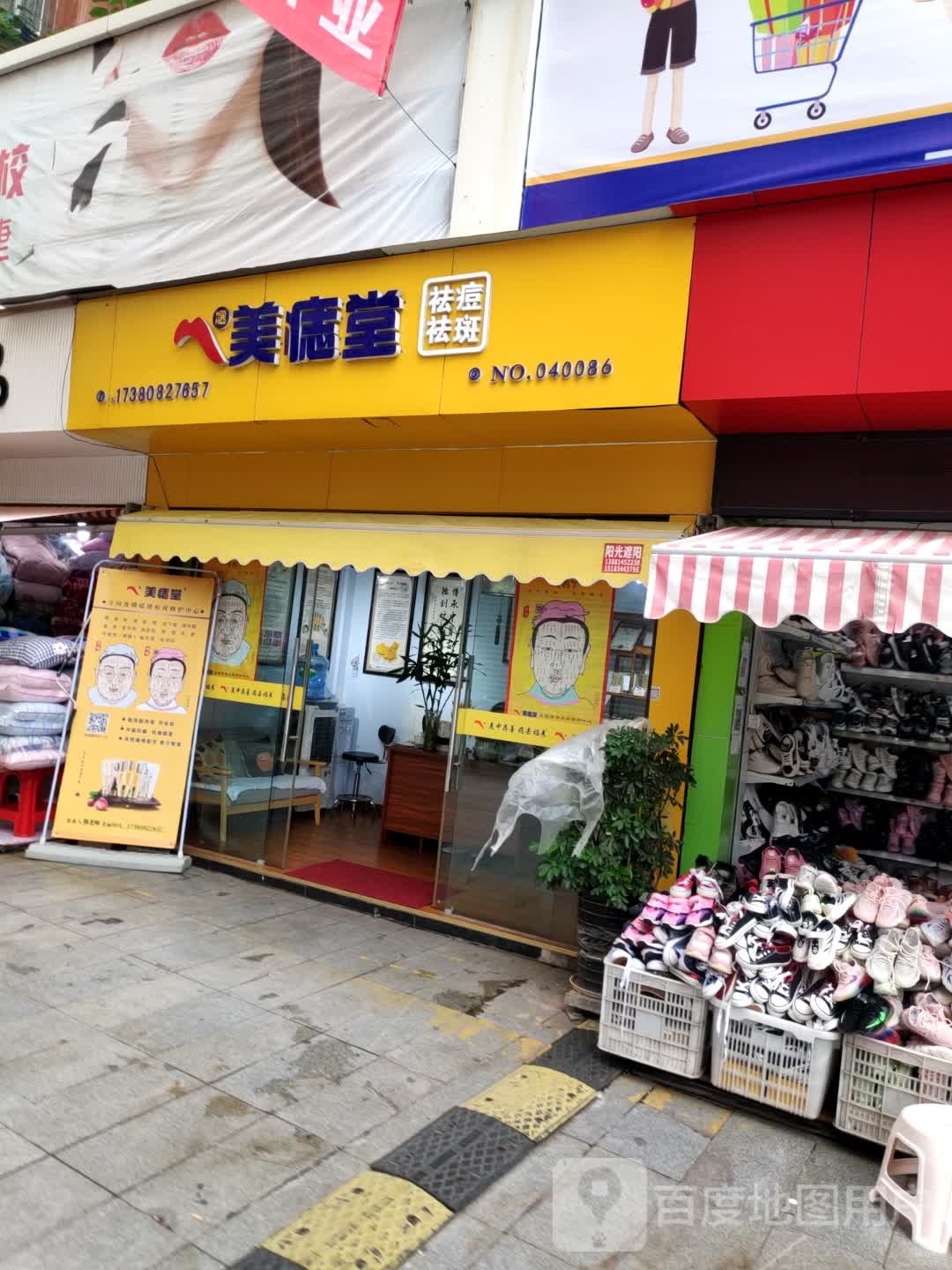 美痣(西昌市三岔口西路店)