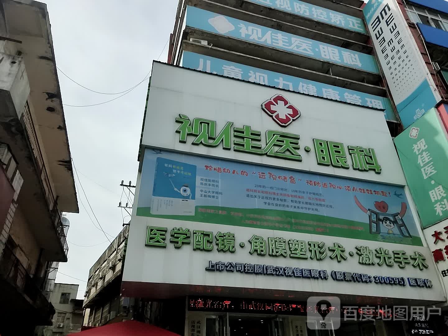 光学配镜角膜塑形术