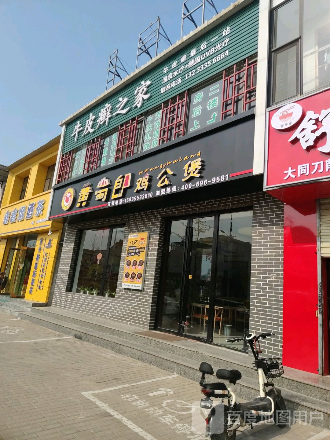 牛皮癣之家