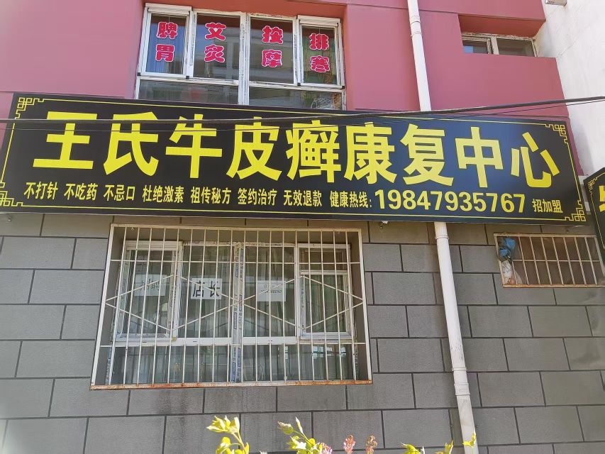 王氏牛皮癣康复中心