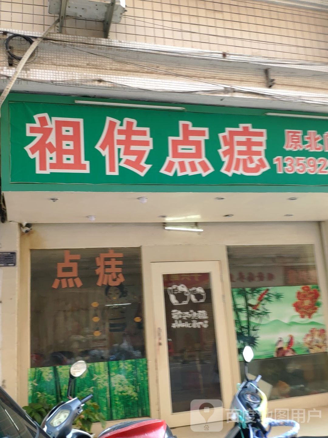 祖传点痣
